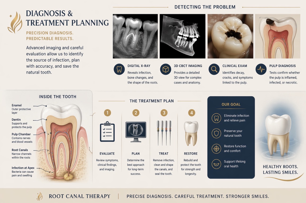 Root canal diagnostic collage with symptoms, X-rays, and treatment planning